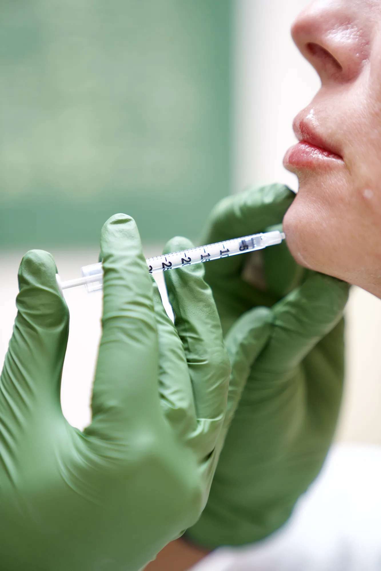 Dermal Filler at Skin Talk