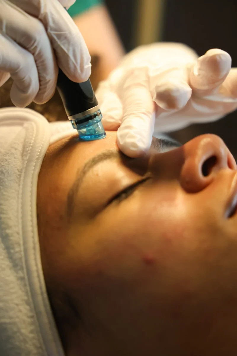 Hydrafacial at Skin Talk