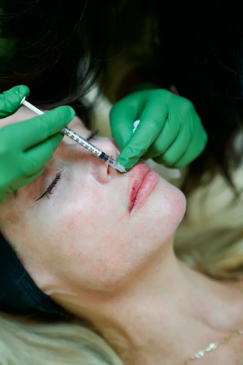 Dermal fillers at Skin Talk