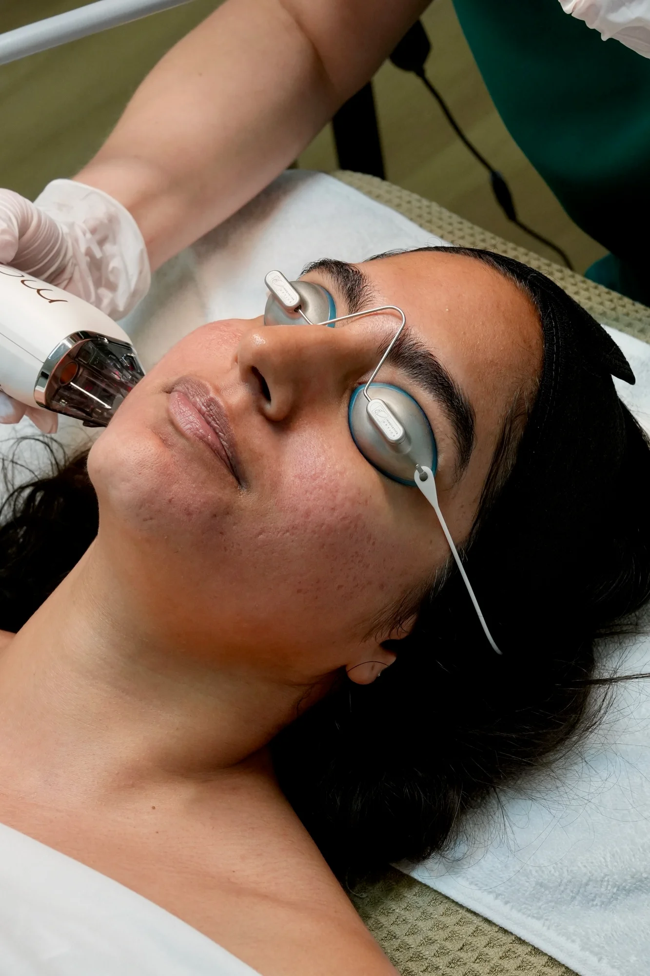 Moxi Laser at Skin Talk