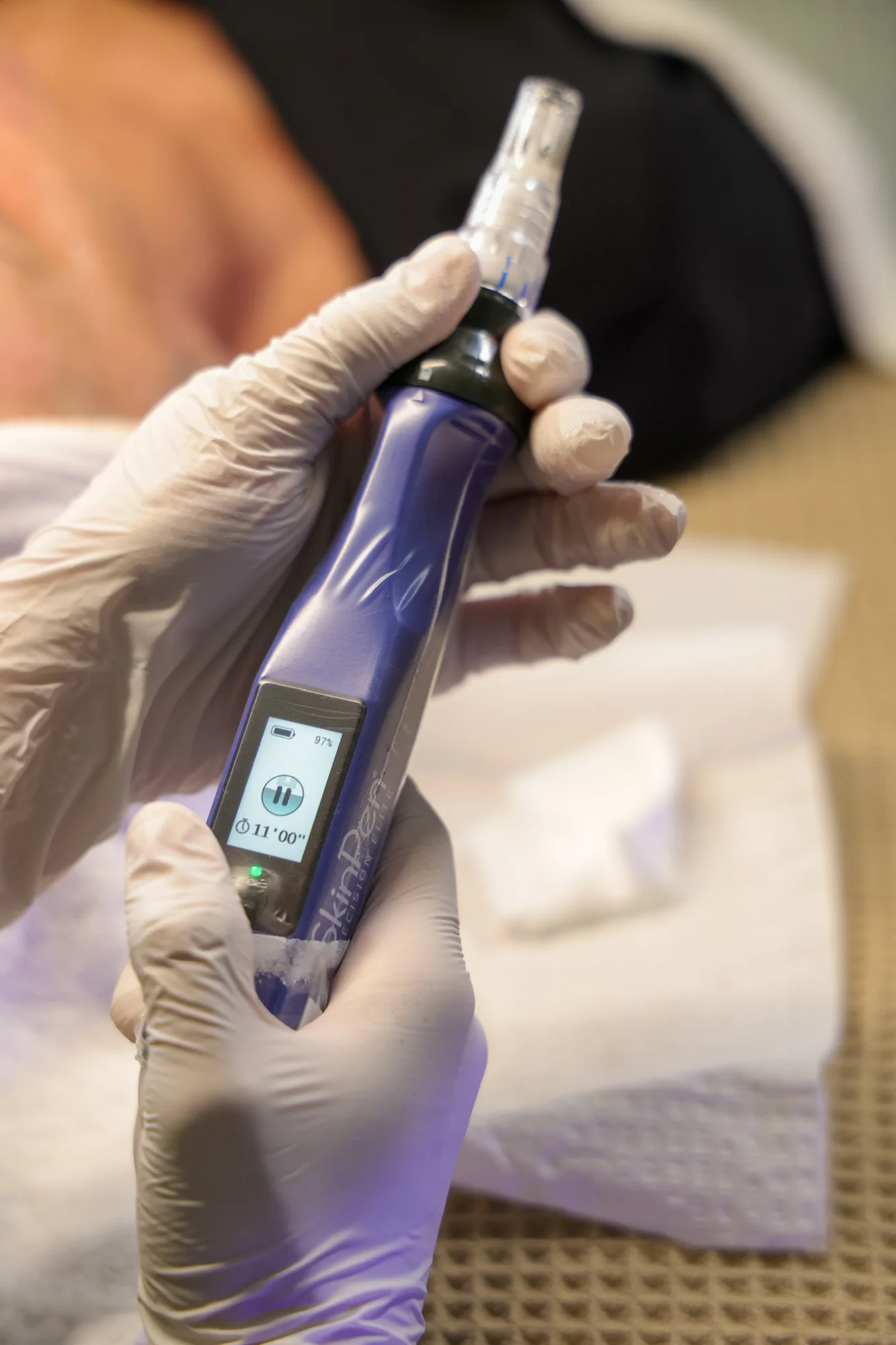 SkinPen Precision Elite in use